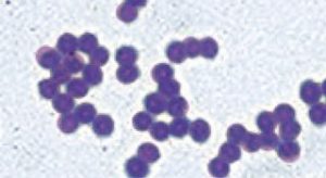 Figure 7. Cocci are perfectly round, similarly sized and are stained purple (x1,000).