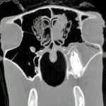 Figure 11. Transverse image from a seven-year-old horse with left-sided nasal discharge and a supernumerary 212. There was a diastema between the 211 and 212 resulting in sinusitis. The tooth was removed via a minimally invasive transbuccal extraction.