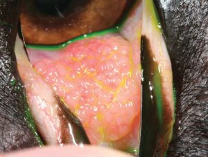 Figure 13b. Same patient as above, follicle formation on the palpebral aspect of the third eyelid.