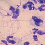 Figure 6. Cytological preparation from a dog with superficial pyoderma. Note the neutrophils, some with intracellular cocci and nuclear strands.