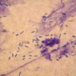 Figure 8. Cytological preparation from a dog with severe Pseudomonas otitis. Note the numerous rod-shaped organisms. The neutrophils are all degenerated to the point that only nuclear strands are present.