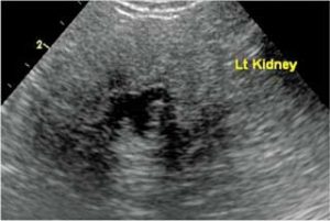 IRIS stage IV chronic kidney disease – intervention at this stage is difficult and may lead to a limited improvement in the patient’s quality of life.