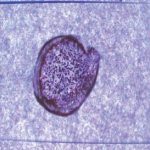 Figure 3. Positive slide agglutination.