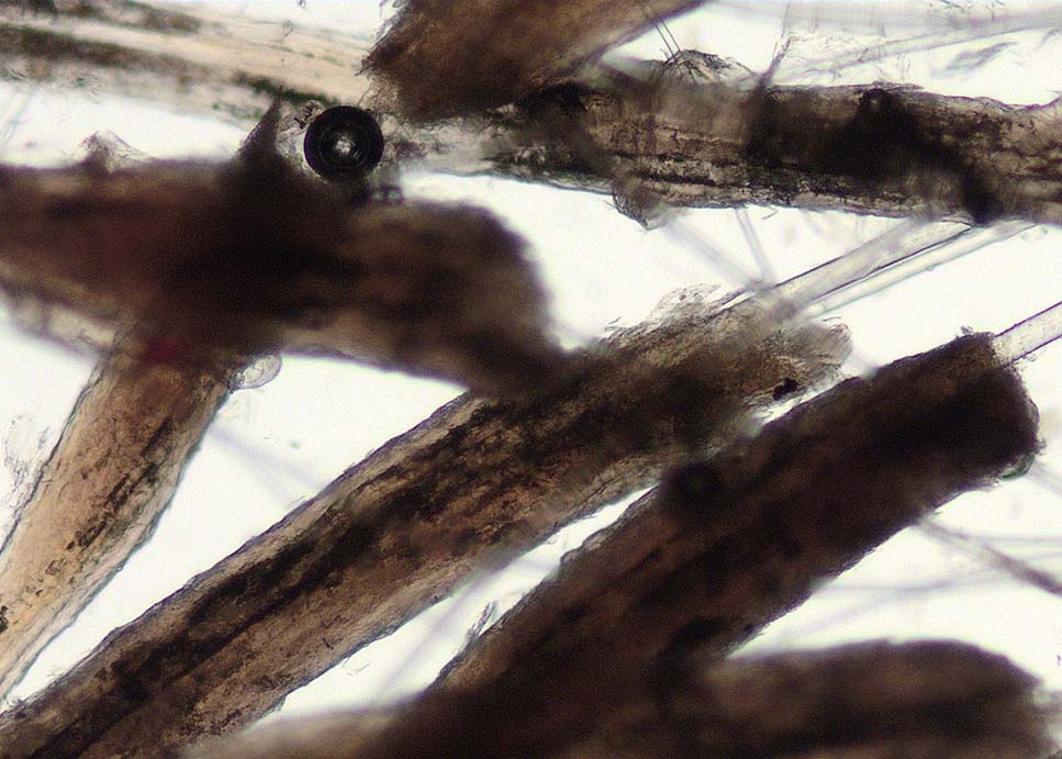 Figure 2. The situation described in Figure 1 under ×10 magnification.