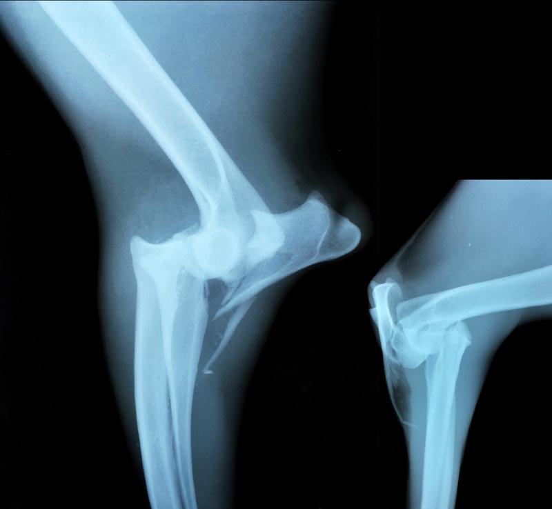 Figure 1. Lateral (left) and craniocaudal views of the right elbow.