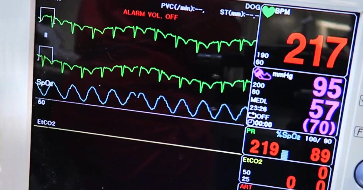 Oxyhaemoglobin dissociation curve, pt 2: pulse oximetry’s limitations