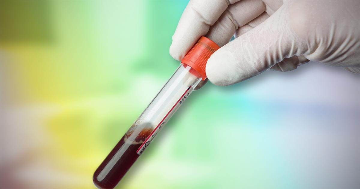 Blood gas analysis, pt 2: acid-base disturbances