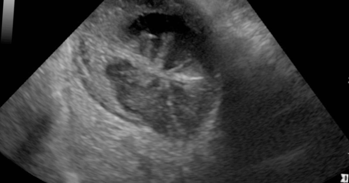 Abdominal ultrasound, pt 1: equipment controls