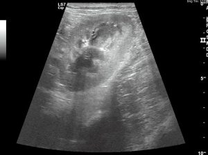 Figure 1c. An ultrasound image of a healthy canine kidney. Image: Anderson Moores Veterinary Specialists.