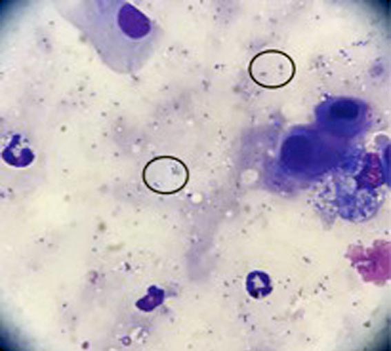Figure 5. Streptococcus sanguinis. Gram-positive. Image: Eva Abarca, Ars Veterinaria