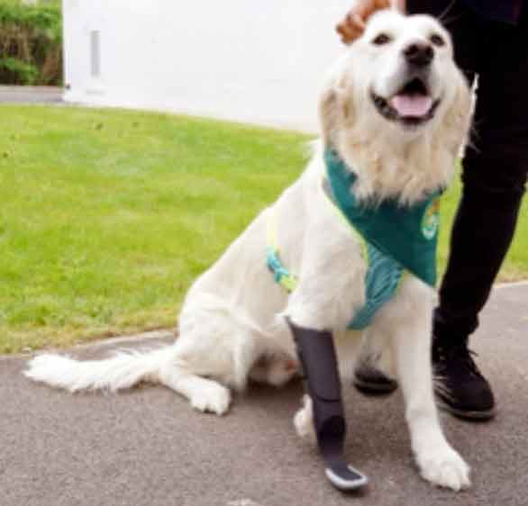 Fitted with a bespoke prosthetic limb. Image: CBM Medical.