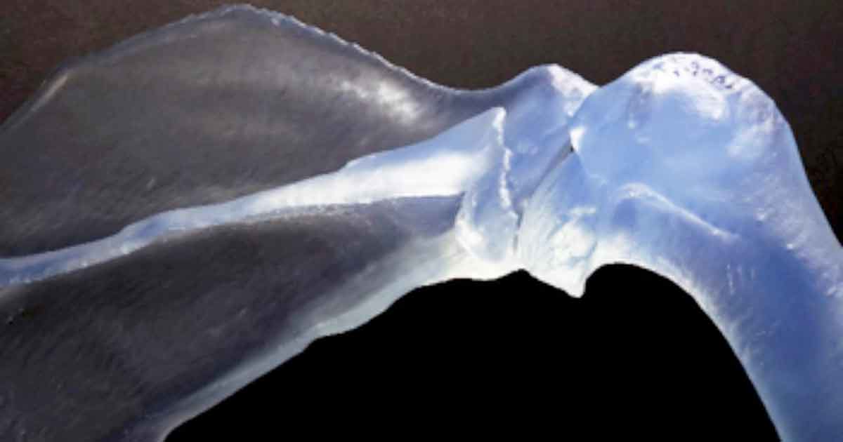 A shoulder joint used as a visual reference in surgery, and a limb model to rehearse surgery.