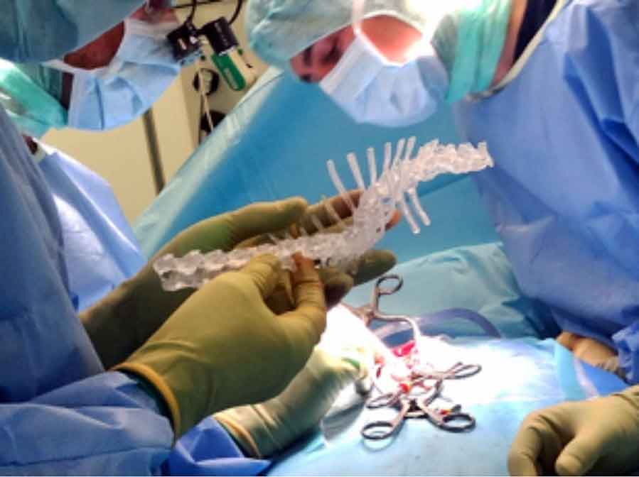 A spine model used as a visual reference in surgery, and a limb model to rehearse surgery.