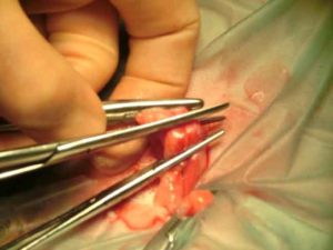 Figure 17. The proximal uterine horn is cut between the forceps.