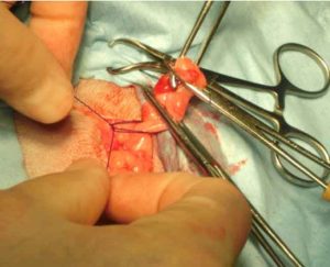 Figure 20. The constrictor knot ligature is slowly tightened, while retaining tension on the ligature loops.