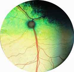 Figure 14c. Fundus in a cat.