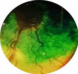 Figure 14d. Tortuous retinal vessels in a dog with hypertensive retinopathy.
