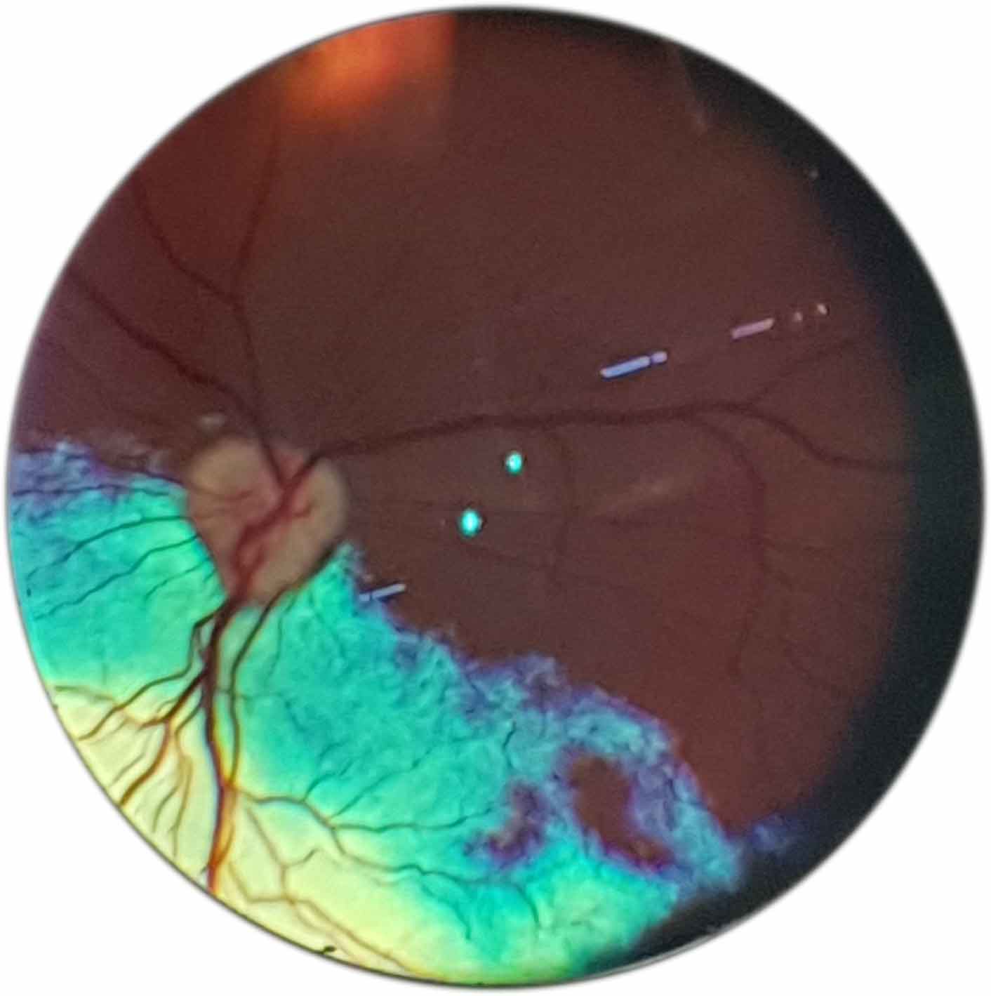 Figure 14a. Fundus pictures taken on a smartphone using a 22D pan retinal Volk lens (Figures 14a-i). This is the normal canine fundus.