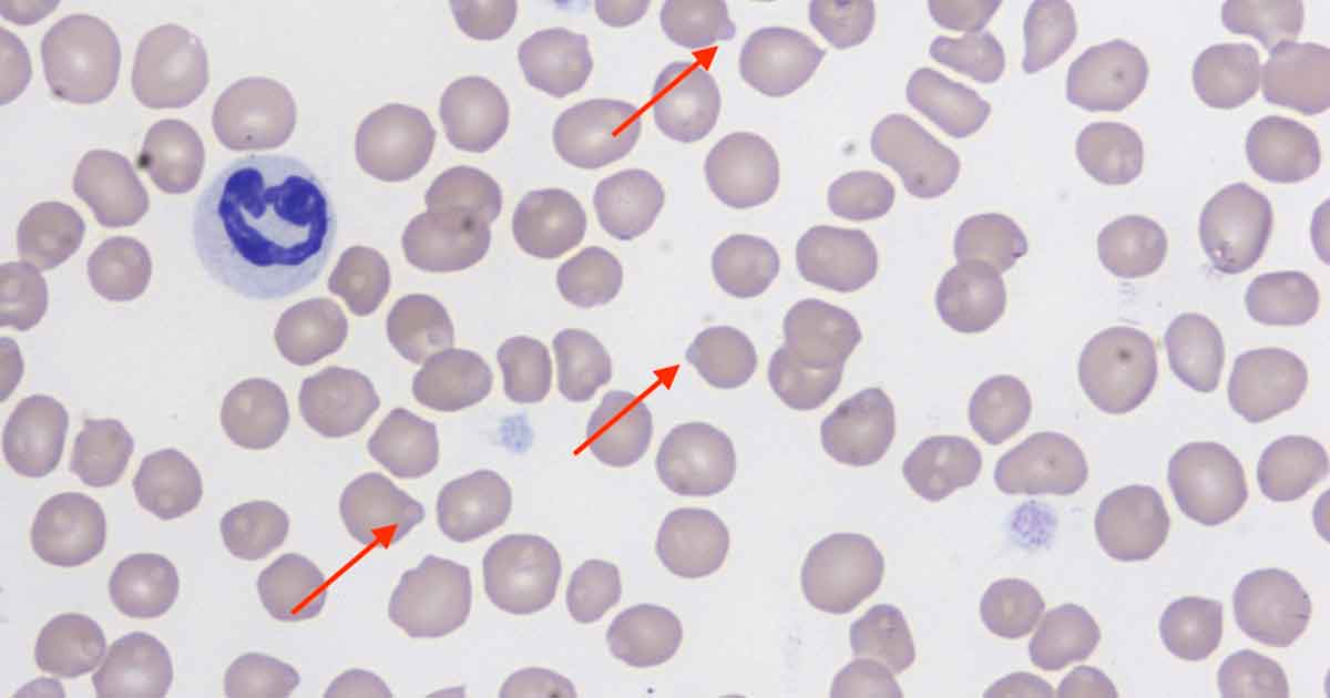 Figure 1. The cat’s blood smear, Wright-Giemsa stain 50×.