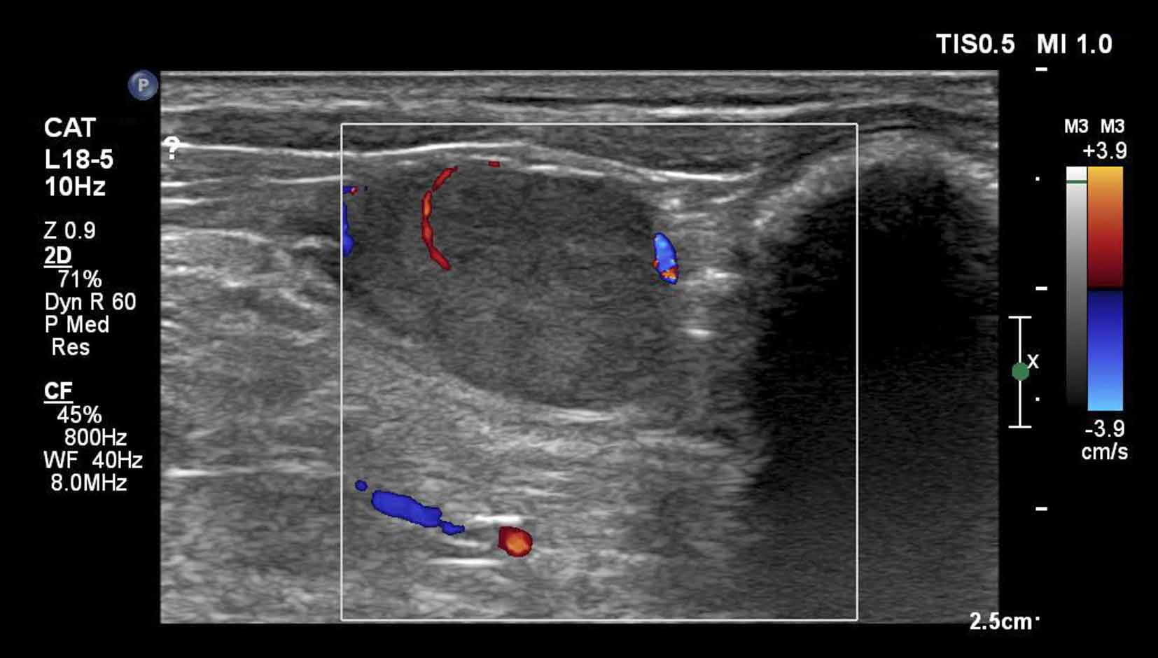 Figure 3. Ultrasound scan revealed an abdominal mass.