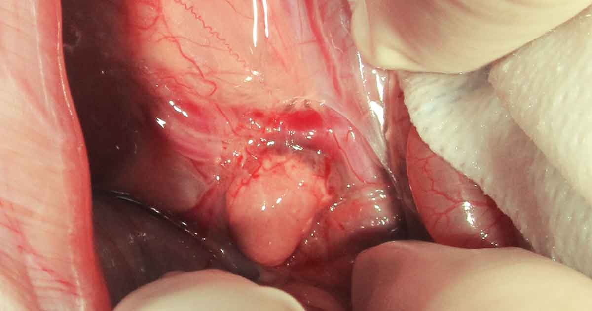 Figure 1. Gross appearance of the abnormal left adrenal gland during exploratory laparotomy.