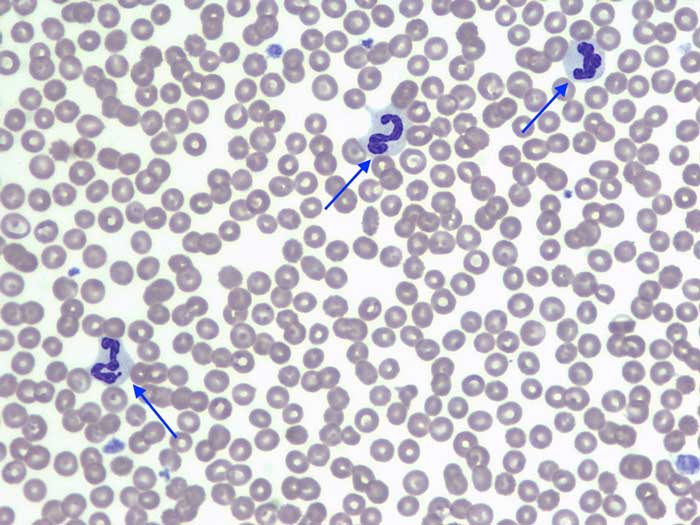 Figure 1. Blood smear image.