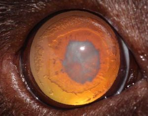 Figure 5. Posterior polar cataract and cortical vacuoles in a dog with progressive retinal atrophy.