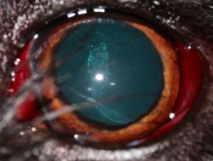 Figure 6. Lens opacity along the posterior sutures lines caused by a blunt trauma. Also note the subconjunctival haemorrhages.