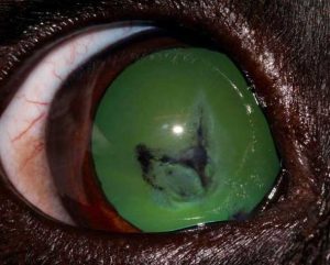 Figure 6a. Lens opacity along the posterior sutures lines caused by a blunt trauma. Also note the subconjunctival haemorrhages.