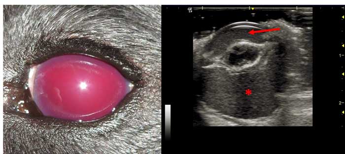 Figure 4. Hyphaema. 4a. The frank blood filling the anterior chamber of this patient prevents direct visualisation of any structures posterior to the hyphaema. 4b. In this case, ultrasound allows assessment of the posterior structures. The normally anechoic anterior chamber is filled by homogenous, echogenic frank blood (red arrow). The lens volume is reduced and echogenic areas are present within the normally anechoic lens, indicating cataractous change. The vitreous body within the posterior segment is also filled with homogenous, echogenic frank blood (red asterisk).