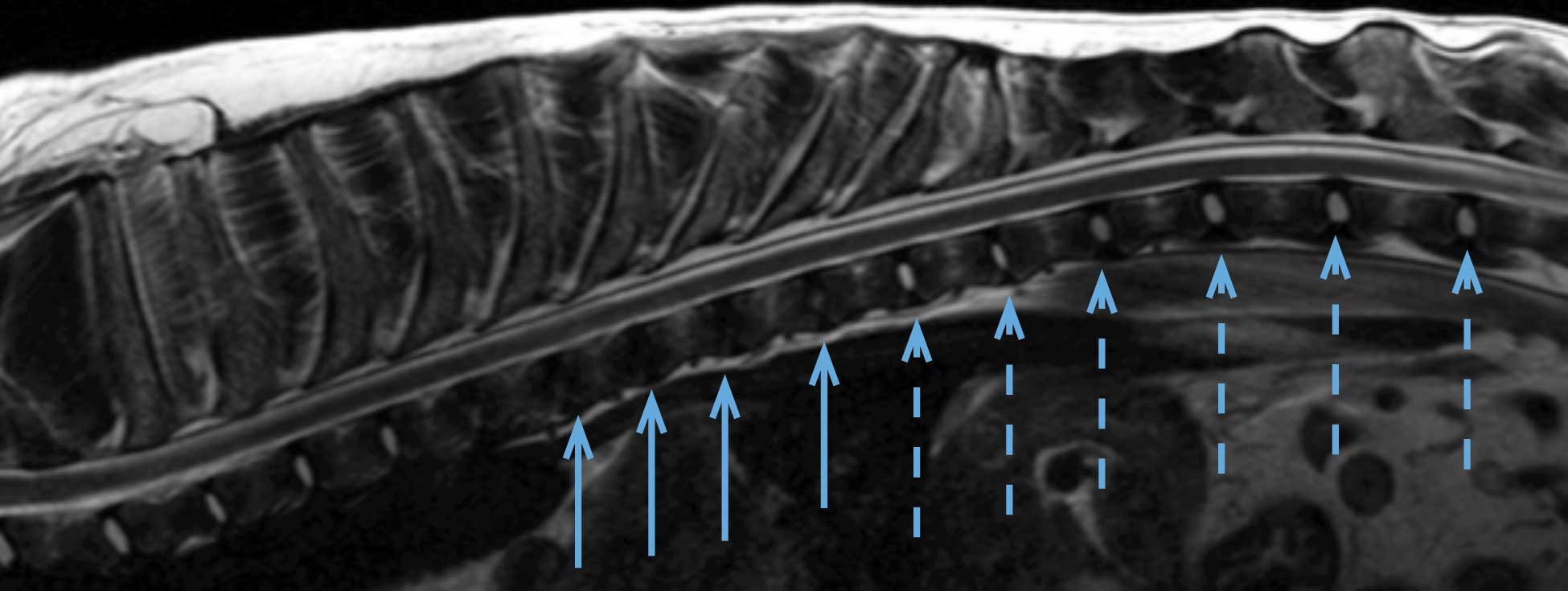 Hansen Types Genetics of disc disease in chondrodystrophic dogs