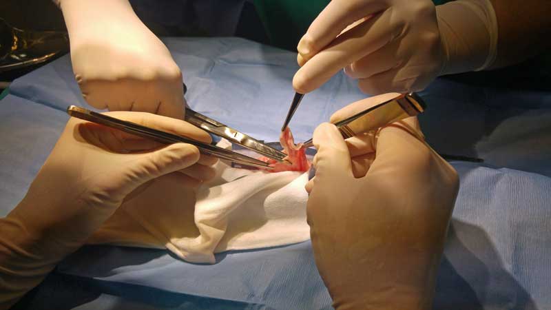 Incision of the pseudocyst.
