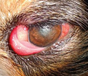 Figure 18. Retrobulbar abscess.