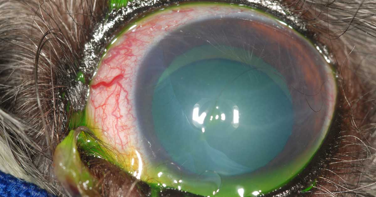 Figure 1. A colour photo of a canine patient with chronic primary glaucoma of the left eye. The eye is buphthalmic with ocular discharge, episcleral injection, diffuse corneal oedema and multifocal Haab’s striae. Lens subluxation and a superior aphakic crescent are also present. This eye was non-visual and despite medical management, frequent increases in intraocular pressure occurred. Enucleation was recommended.
