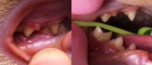 Figure 4. Caudal malocclusion with traumatic pyogranuloma in an eight-month-old domestic shorthair cat. Note the proximity of the marked inflammation to the mandibular first molar tooth. The periodontal health of this tooth is commonly compromised in these cases and extraction may be required. Treatment in this case consisted of crown height reduction of the maxillary third and fourth premolar teeth, together with resection of the granulomatous tissue.