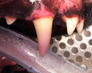 Figure 7. Discoloured right maxillary canine tooth. The tooth is purple in the coronal segment, whereas the more apical segment shows a yellow/grey discolouration. The discolouration is secondary to pulpitis resulting from blunt trauma. Endodontic treatment of this tooth was performed.