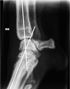 Figure 8c. Stressed radiograph demonstrating palmar ligament failure at the level of the mid-carpal joint. This is a candidate for partial carpal arthrodesis.