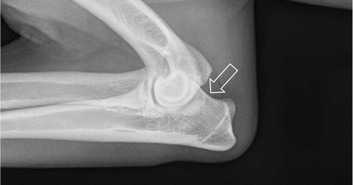 Figure 3a. Flexed mediolateral view highlighting proximal border of anconeal process.