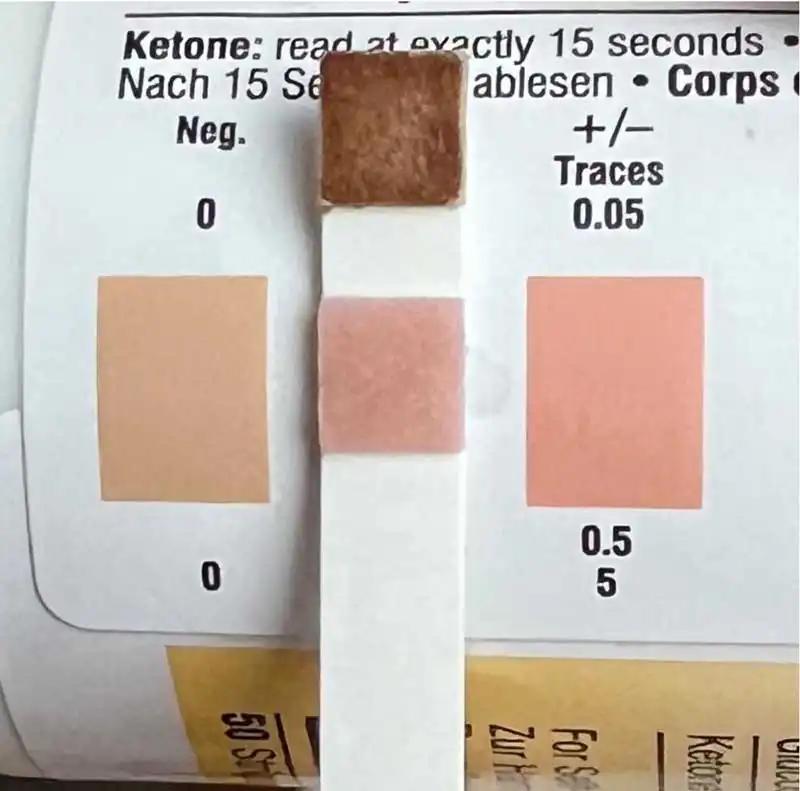 Figure 2b. Even a trace of ketones in the urine is significant in a cat on velagliflozin. This patient had a blood ketone level of 3.1mmol/L. Both methods of measuring ketones are valid, but the blood ketone method is more sensitive.