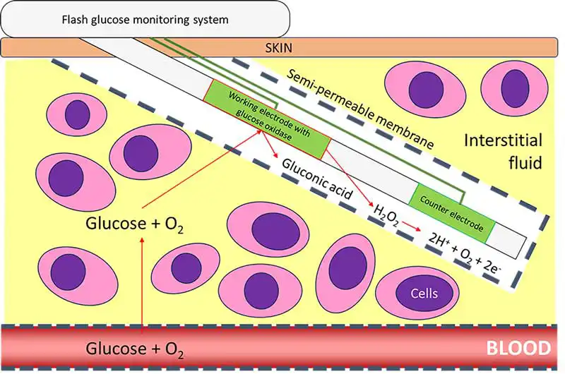 Figure 3. The principle of flash glucose monitoring systems.