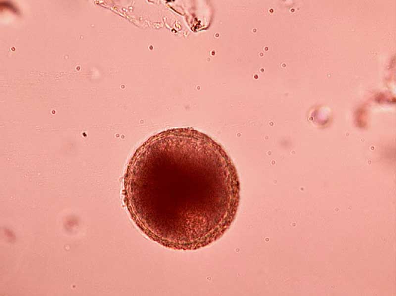 Figure 1. Toxocara species egg.