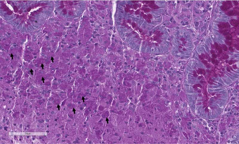 Figure 3. Histology of a colonic biopsy of a dog with granulomatous colitis. Image: © Courtesy of Roberta Rasotto 