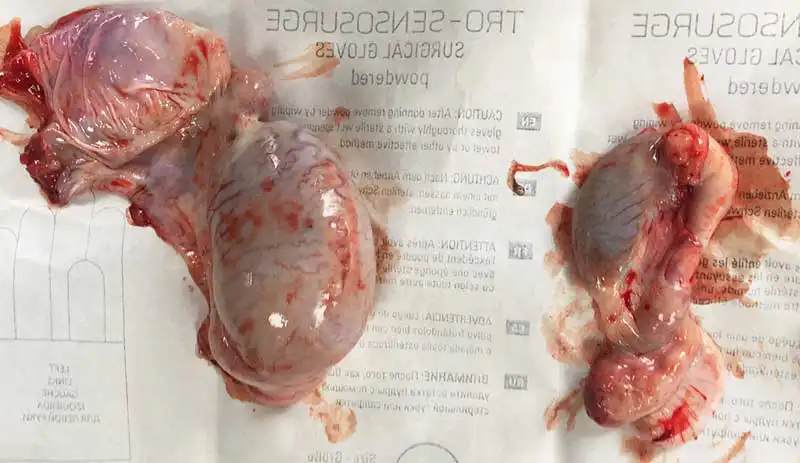 Figure 5. Removed testicles demonstrating one much smaller testicle.