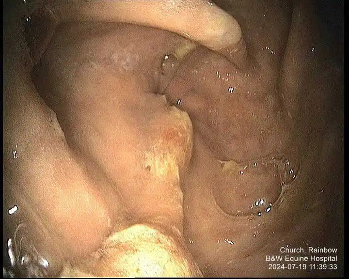 Figure 3. Moderate multifocal raised and fibrinosuppurative, antrum and pylorus.