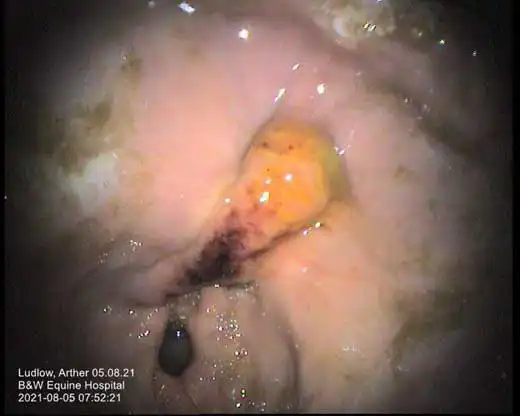 Figure 4. Severe multifocal raised haemorrhagic and fibrinosuppurative, pylorus and antrum.