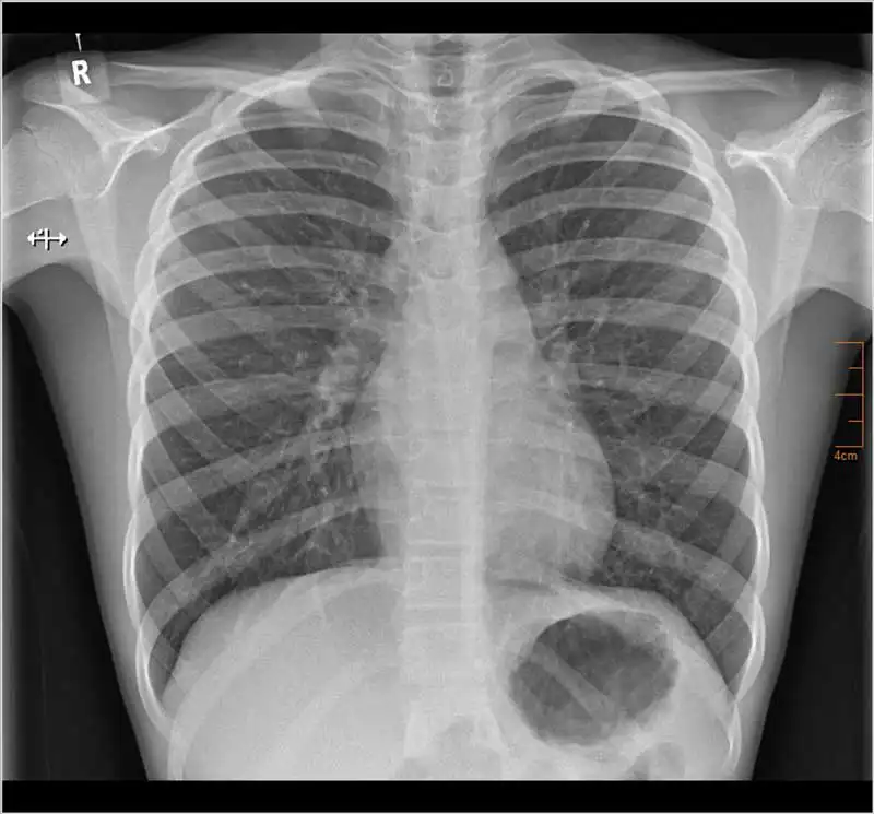 Figure 1. An x-ray study of the author’s daughter.