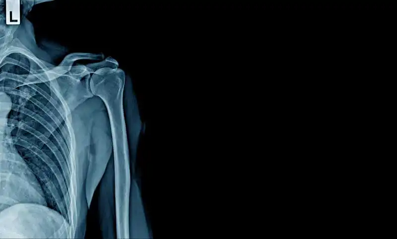 x-ray Image: angkhan / Adobe Stock