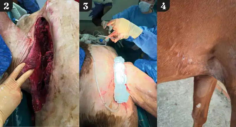 Figure 2. Large full thickness wound in the axilla region of a horse. Figure 3. The wound was debrided, lavaged and closed by primary intention. A closed suction drain system was placed to help remove exudate and debris, and help close the dead space. While not as efficient as negative pressure therapy, this can be an economic and easily available alternative. Figure 4. Picture of the wound once healed yielding good cosmetic results.