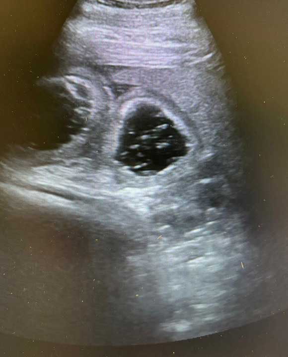 Figure 3. Distended small intestine visible on ultrasound with markedly thickened wall. Image: Kim Davies