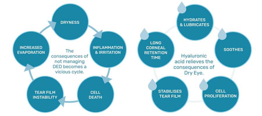 Figure 6. The consequences of dry eye can be relieved with hyaluronic acid; a lacrimomimetic.